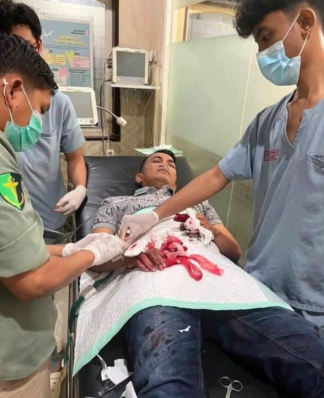 Juru Parkir di Jalan Tombolotutu Ditembak OTK, Dedi Dilaporkan Terkena Delapan Tembakan